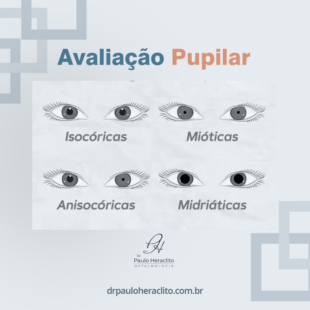 Avalia O Pupilar Dr Paulo H